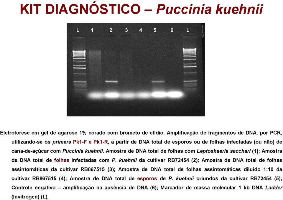 Amostra de DNA total de folhas com Leptoshaeria sacchari (1); Amostra de DNA total de folhas infectadas com P.