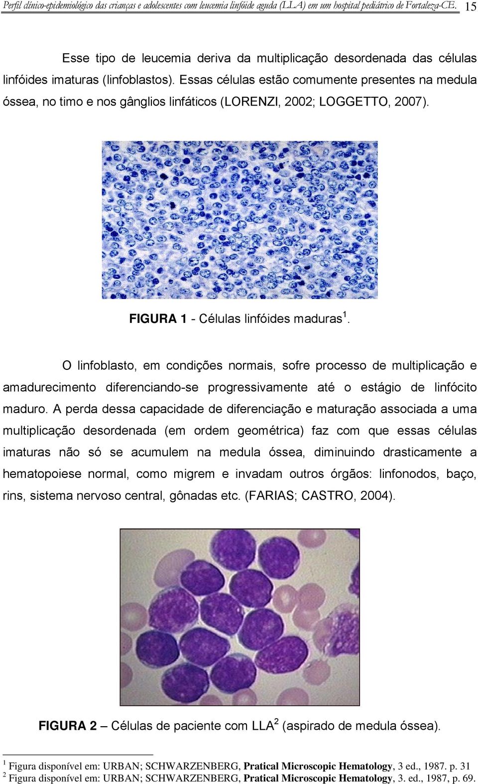 Essas células estão comumente presentes na medula óssea, no timo e nos gânglios linfáticos (LORENZI, 2002; LOGGETTO, 2007). FIGURA 1 - Células linfóides maduras 1.