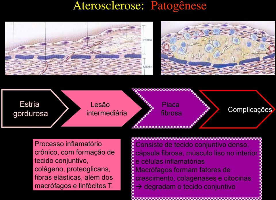 dos macrófagos e linfócitos T.