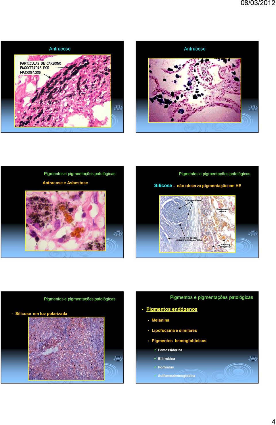 Pigmentos endógenos Melanina Lipofucsina e similares Pigmentos