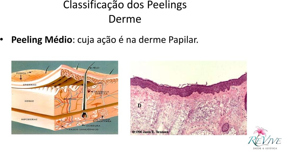 Peeling Médio: cuja
