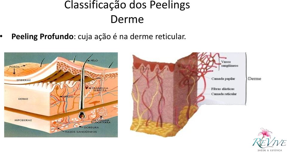 Peeling Profundo:
