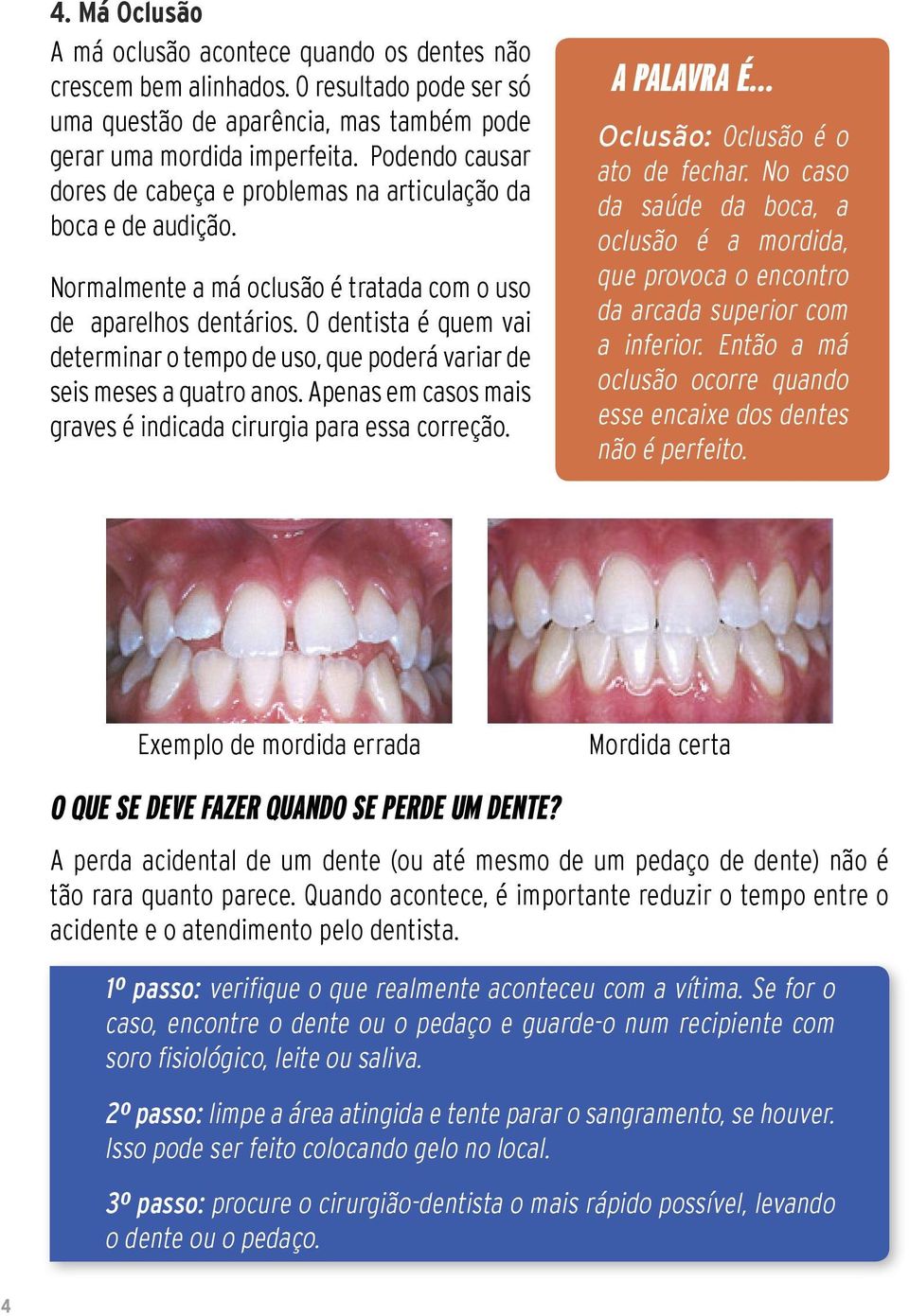 O dentista é quem vai determinar o tempo de uso, que poderá variar de seis meses a quatro anos. Apenas em casos mais graves é indicada cirurgia para essa correção. A PALAVRA É.