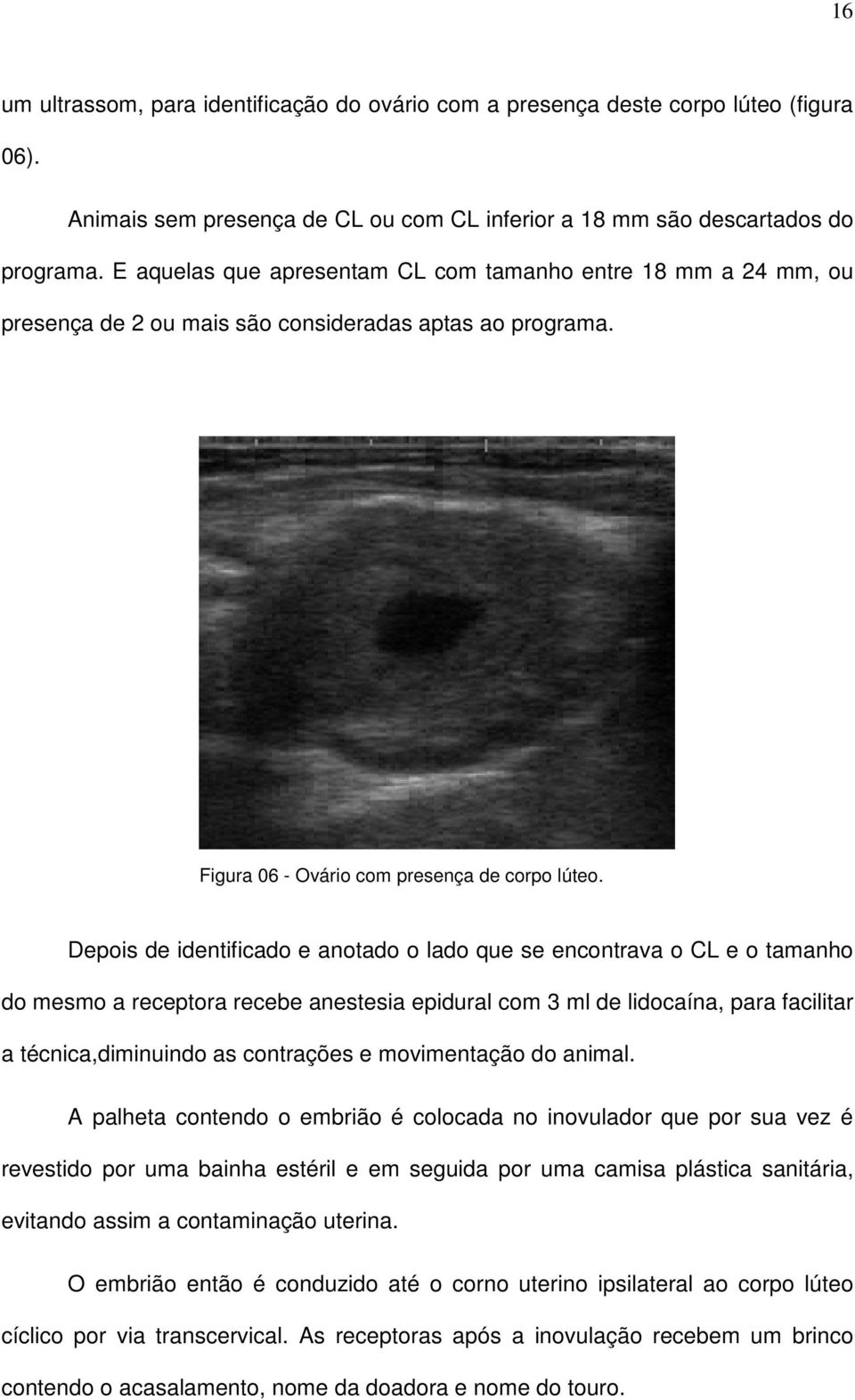 Depois de identificado e anotado o lado que se encontrava o CL e o tamanho do mesmo a receptora recebe anestesia epidural com 3 ml de lidocaína, para facilitar a técnica,diminuindo as contrações e