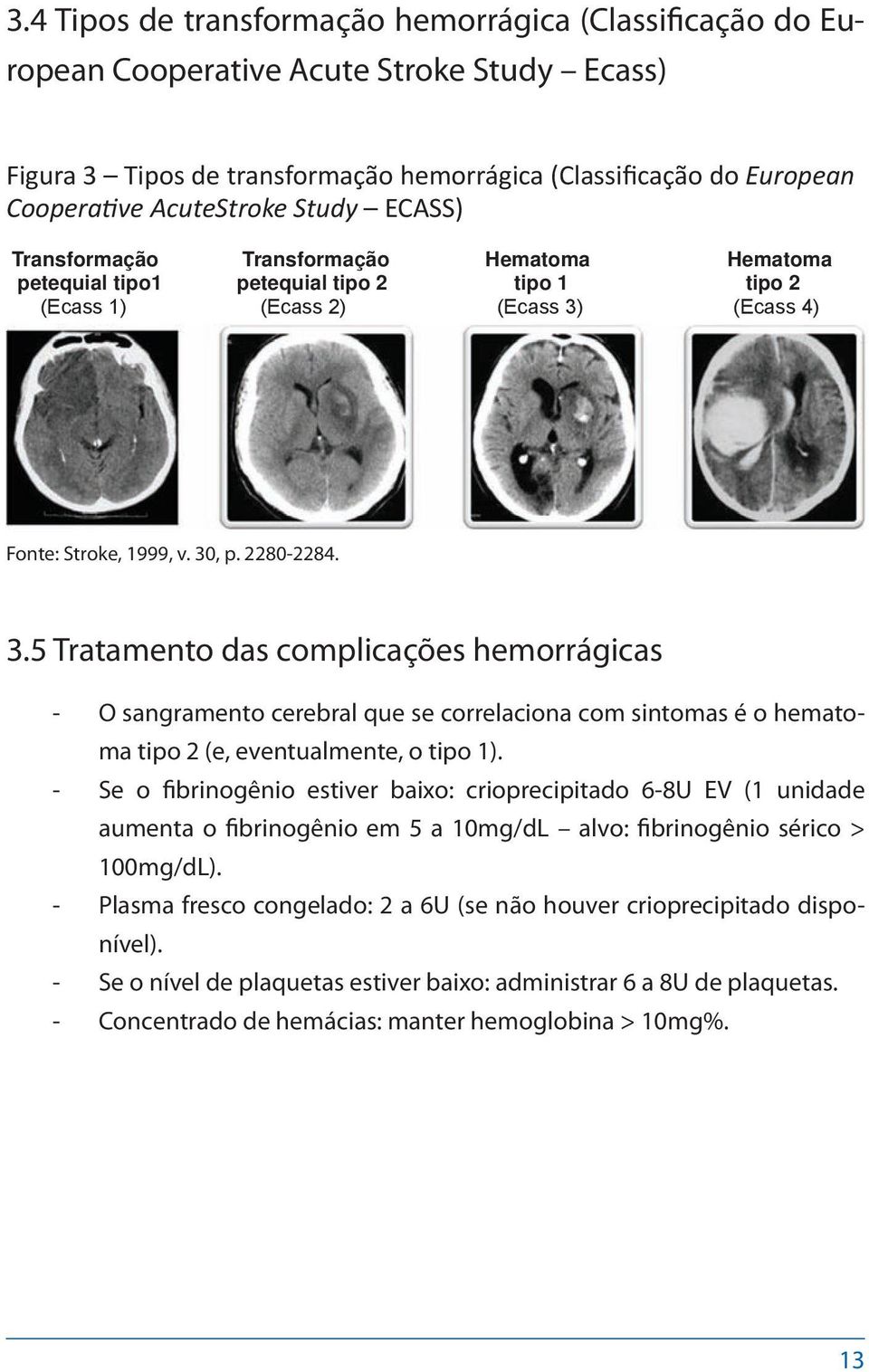 (Ecass 4) Fonte: Stroke, 1999, v. 30, p. 2280-2284. 3.5 Tratamento das complicações hemorrágicas O sangramento cerebral que se correlaciona com sintomas é o hematoma tipo 2 (e, eventualmente, o tipo 1).