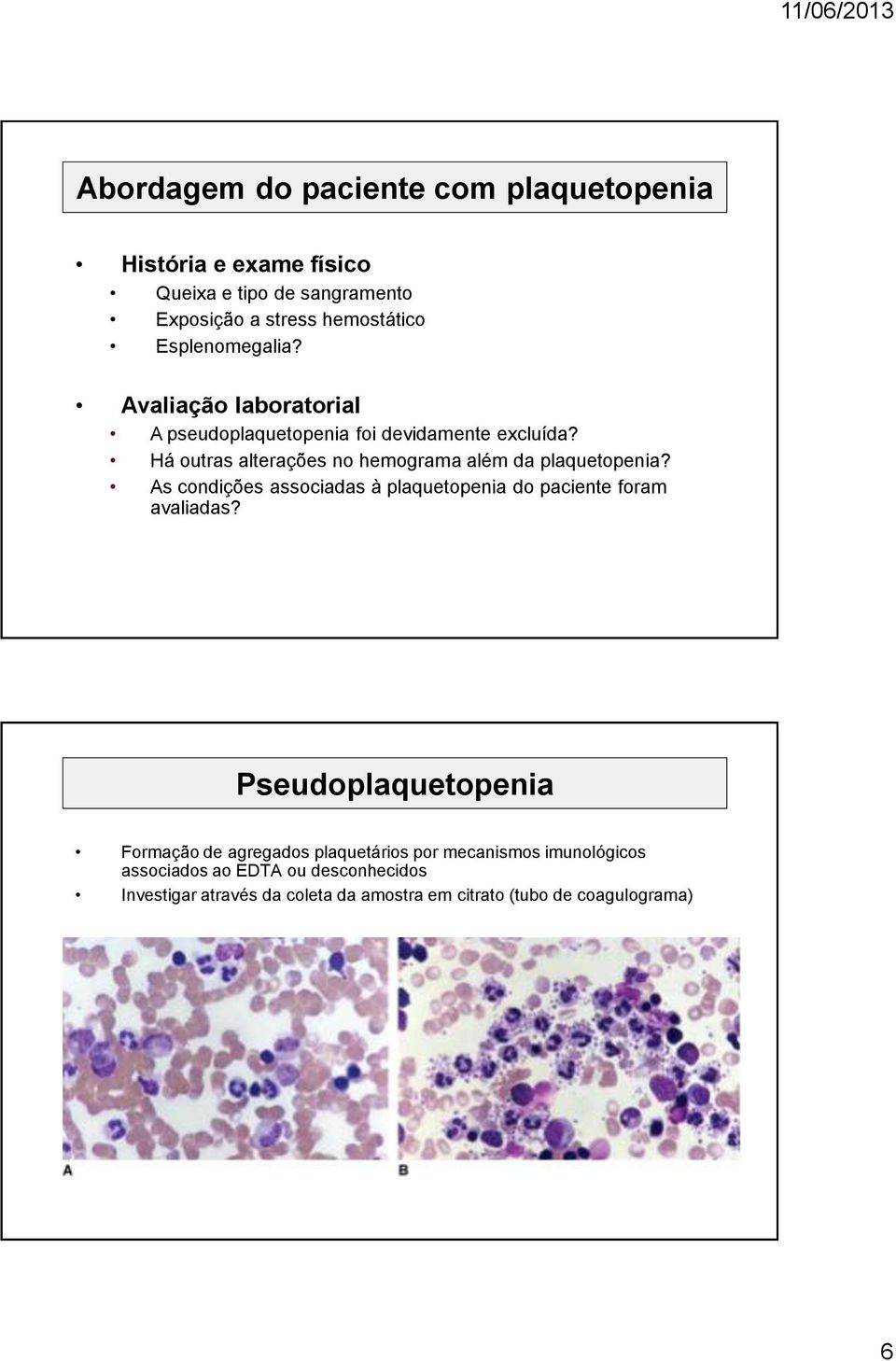 Há outras alterações no hemograma além da plaquetopenia? As condições associadas à plaquetopenia do paciente foram avaliadas?