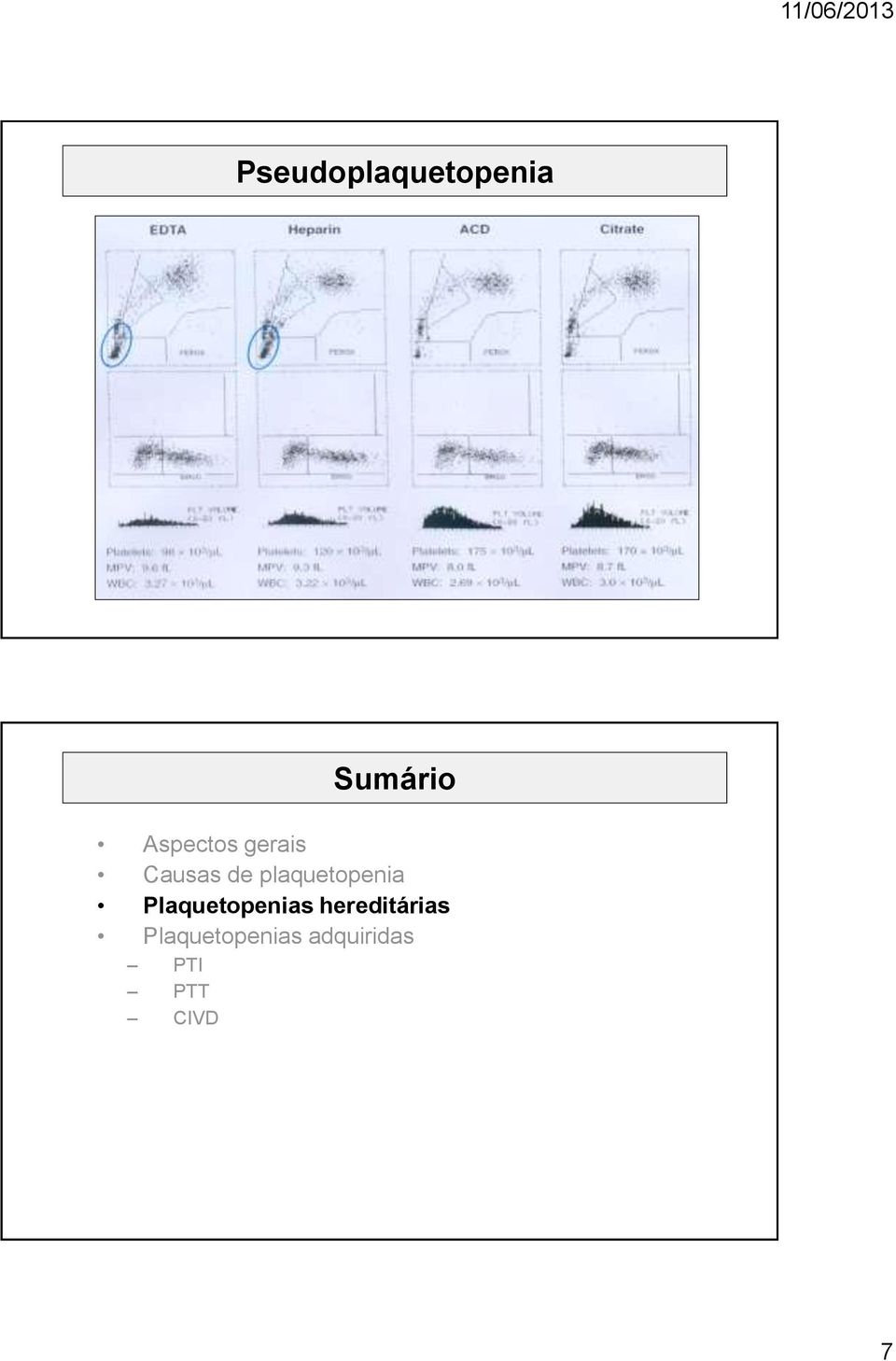 plaquetopenia Plaquetopenias