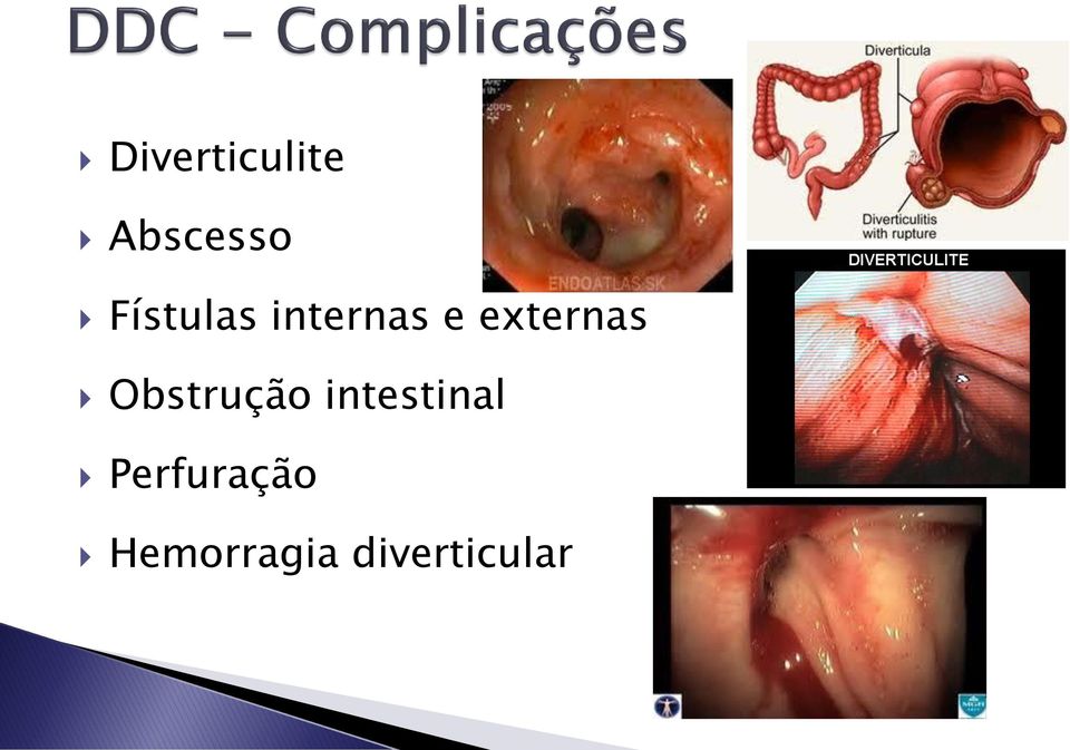 externas Obstrução