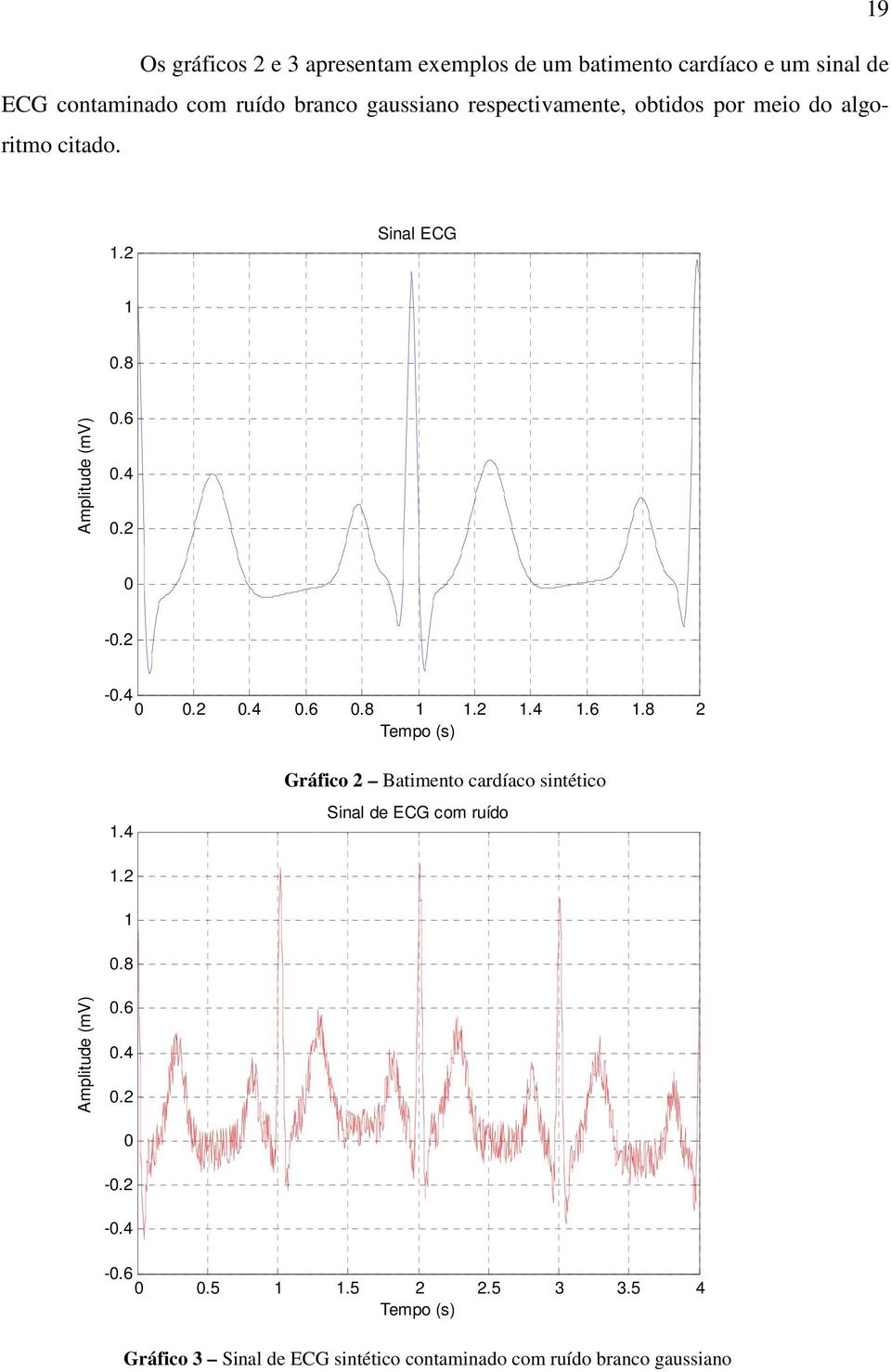 4 Gráfico 2 Batiento cardíaco sintético Sinal de ECG co ruído.2.8 Aplitude (V).6.4.2 -.2 -.4 -.6.5.5 2 2.