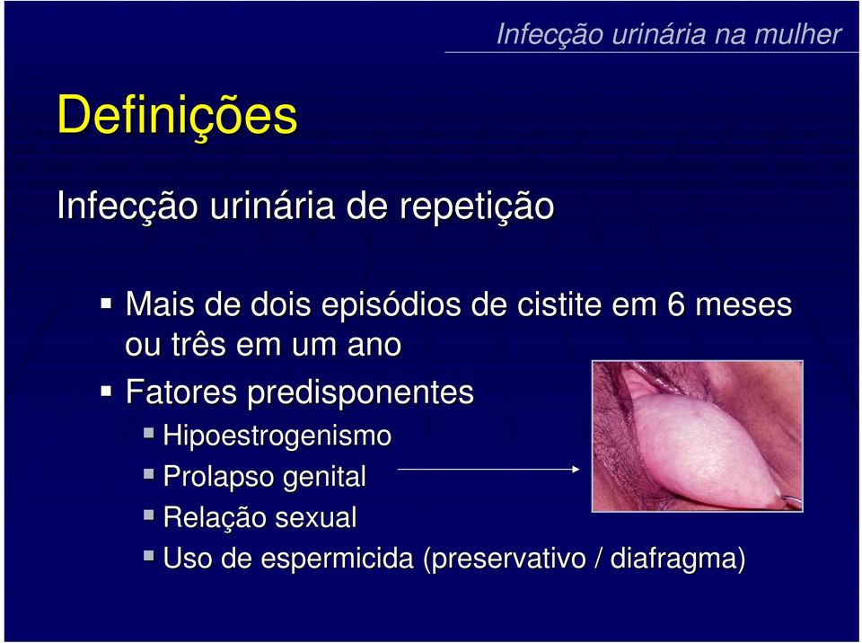 Fatores predisponentes Hipoestrogenismo Prolapso genital