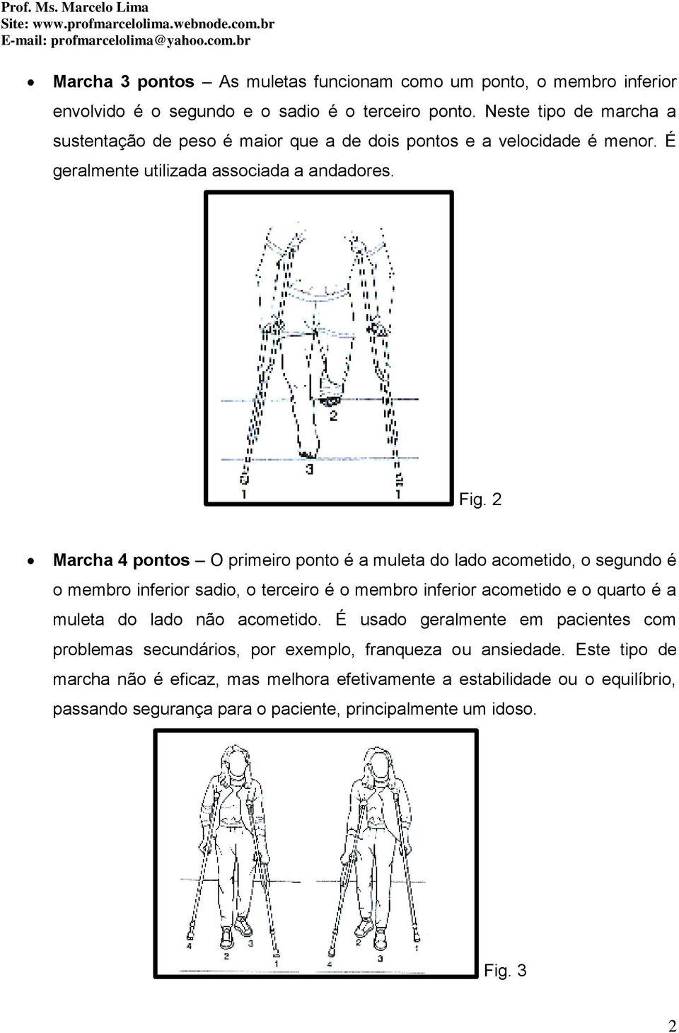 2 Marcha 4 pontos O primeiro ponto é a muleta do lado acometido, o segundo é o membro inferior sadio, o terceiro é o membro inferior acometido e o quarto é a muleta do lado não