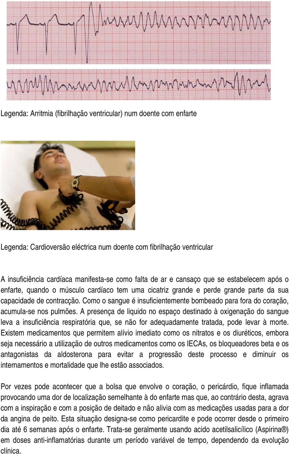 Como o sangue é insuficientemente bombeado para fora do coração, acumula-se nos pulmões.