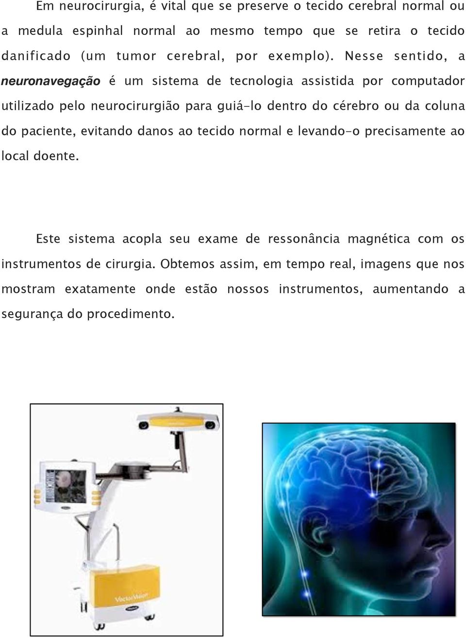 Nesse sentido, a neuronavegação é um sistema de tecnologia assistida por computador utilizado pelo neurocirurgião para guiá-lo dentro do cérebro ou da coluna do
