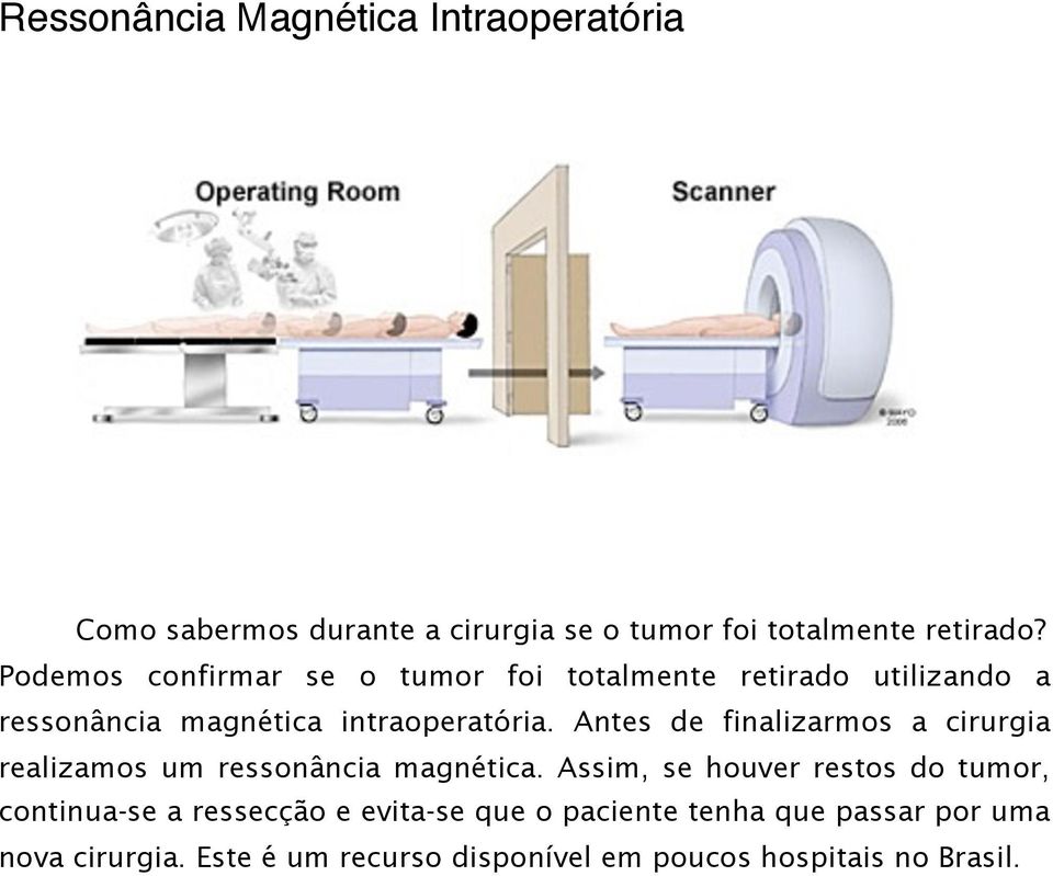 Antes de finalizarmos a cirurgia realizamos um ressonância magnética.