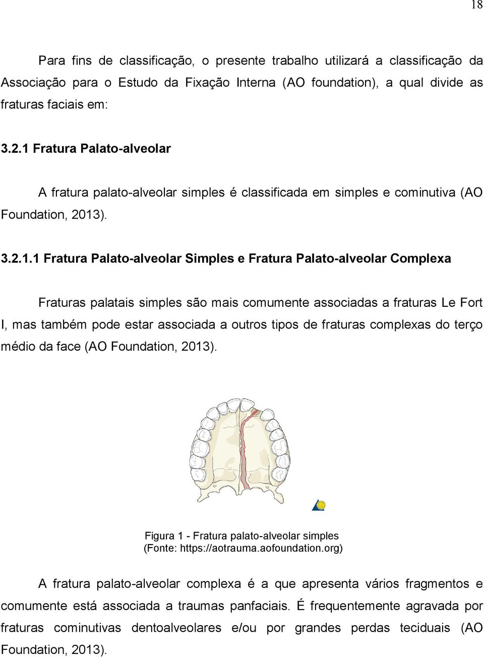Fraturas palatais simples são mais comumente associadas a fraturas Le Fort I, mas também pode estar associada a outros tipos de fraturas complexas do terço médio da face (AO Foundation, 2013).