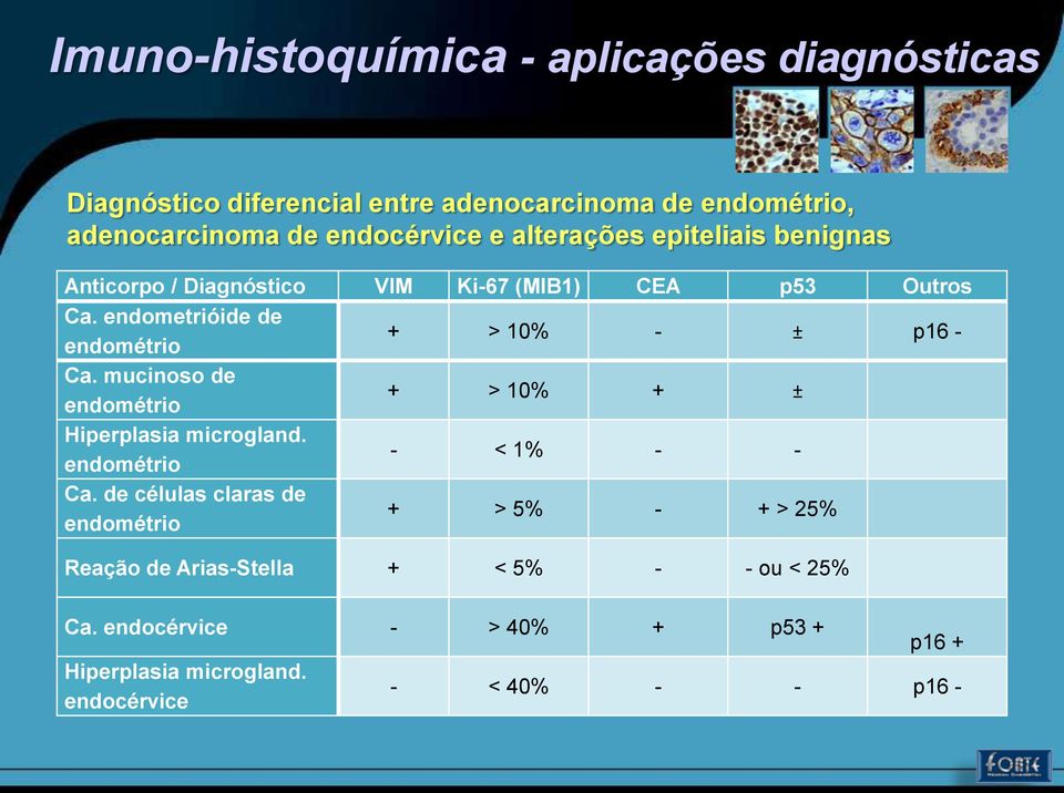 mucinoso de endométrio + > 10% + ± Hiperplasia microgland. endométrio - < 1% - - Ca.
