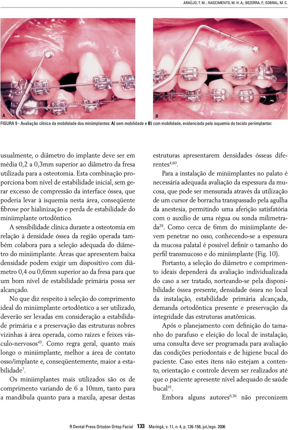 usualmente, o diâmetro do implante deve ser em média 0,2 a 0,3mm superior ao diâmetro da fresa utilizada para a osteotomia.