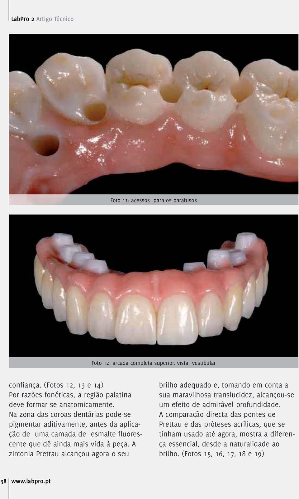 Na zona das coroas dentárias pode-se pigmentar aditivamente, antes da aplicação de uma camada de esmalte fluorescente que dê ainda mais vida à peça.