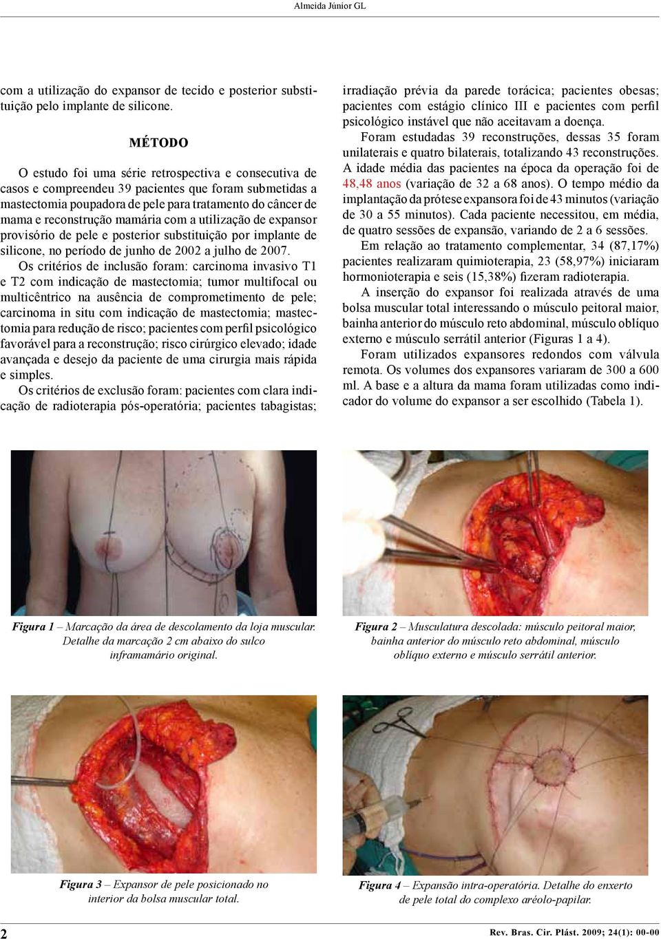 mamária com a utilização de expansor provisório de pele e posterior substituição por implante de silicone, no período de junho de 2002 a julho de 2007.