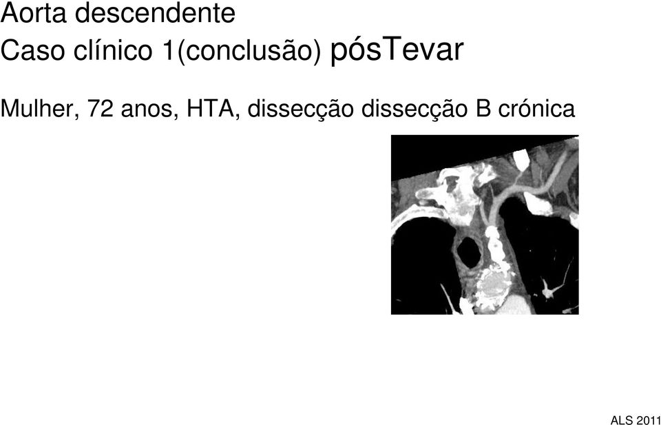 póstevar Mulher, 72 anos,