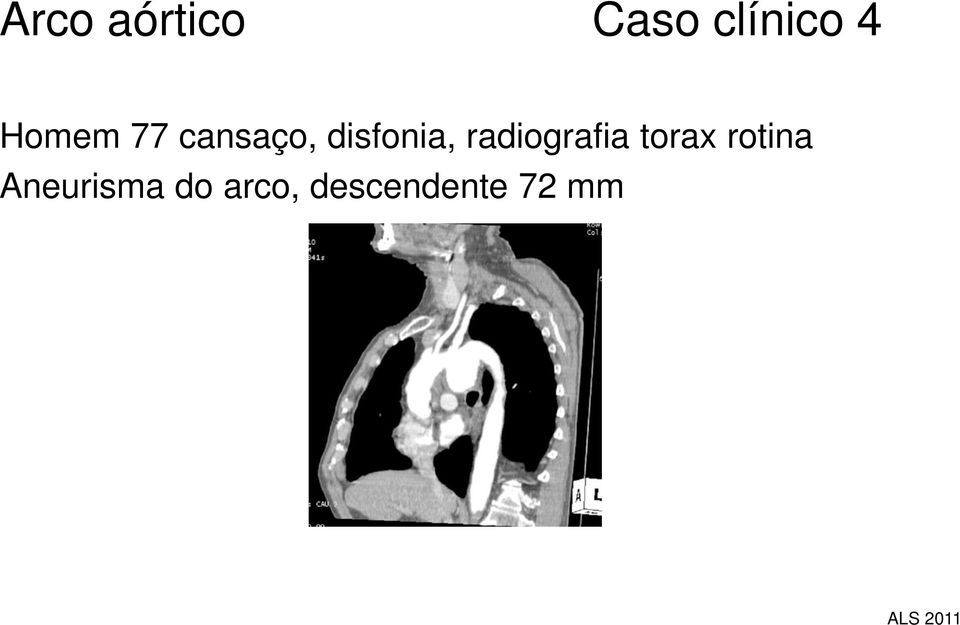 radiografia torax rotina
