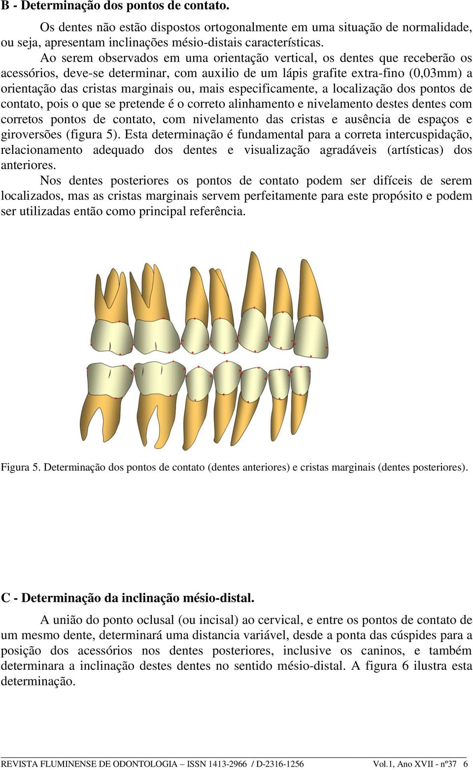 mais especificamente, a localização dos pontos de contato, pois o que se pretende é o correto alinhamento e nivelamento destes dentes com corretos pontos de contato, com nivelamento das cristas e