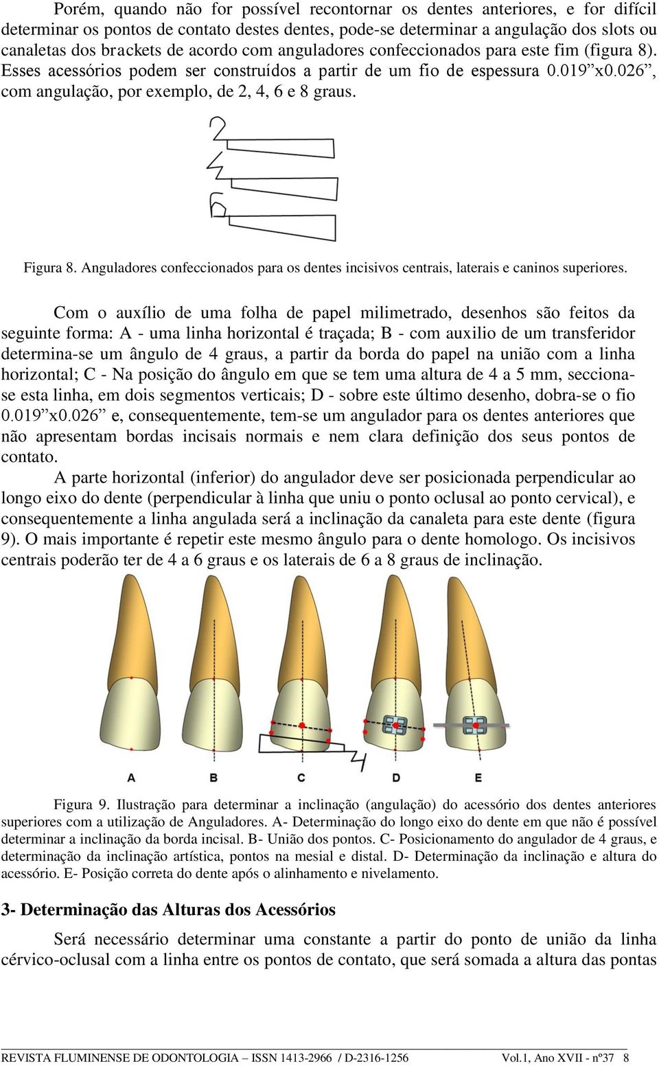 Figura 8. Anguladores confeccionados para os dentes incisivos centrais, laterais e caninos superiores.