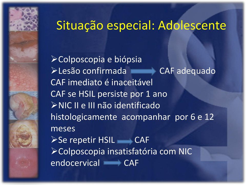 NIC II e III não identificado histologicamente acompanhar por 6 e 12