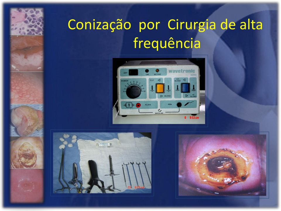 Cirurgia