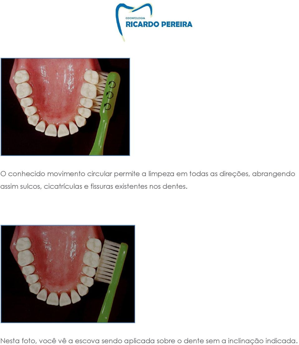 e fissuras existentes nos dentes.