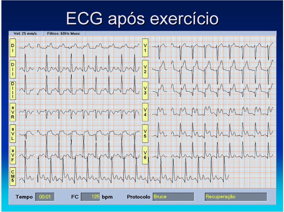 exercício