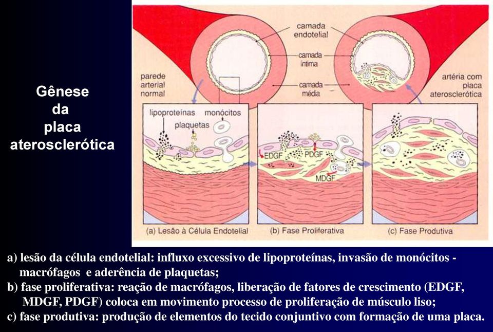 macrófagos, liberação de fatores de crescimento (EDGF, MDGF, PDGF) coloca em movimento processo de