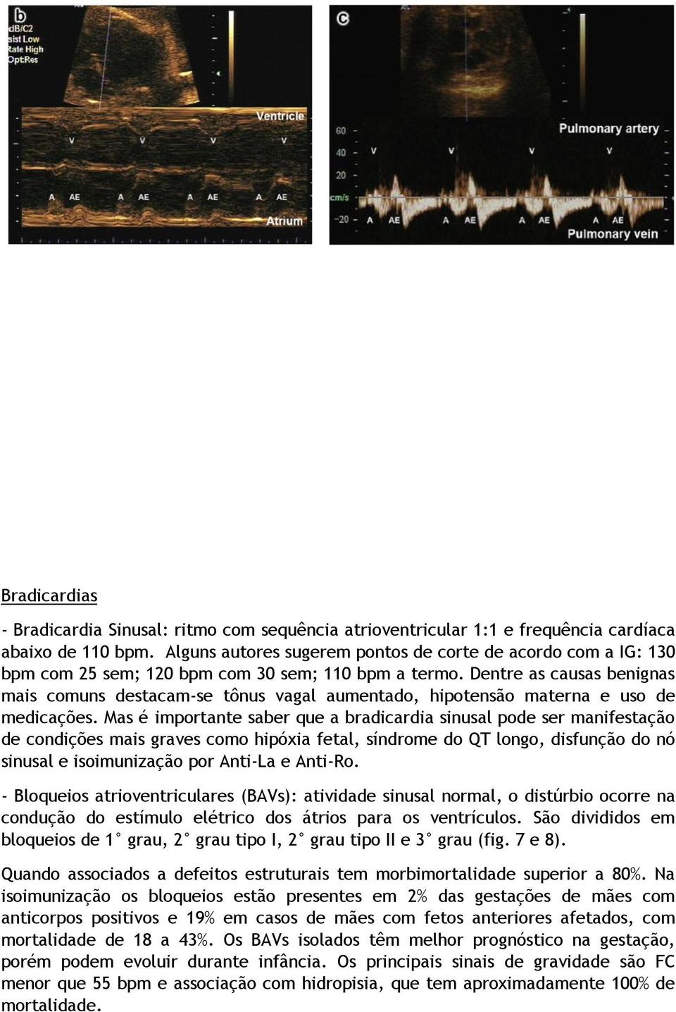 Alguns autores sugerem pontos de corte de acordo com a IG: 130 bpm com 25 sem; 120 bpm com 30 sem; 110 bpm a termo.