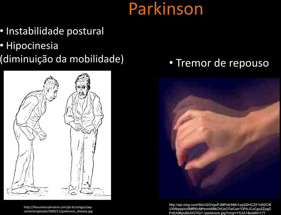 com/pt-br/artigos/wpcontent/uploads/2009/11/parkinson_disease.jpg http://api.ning.