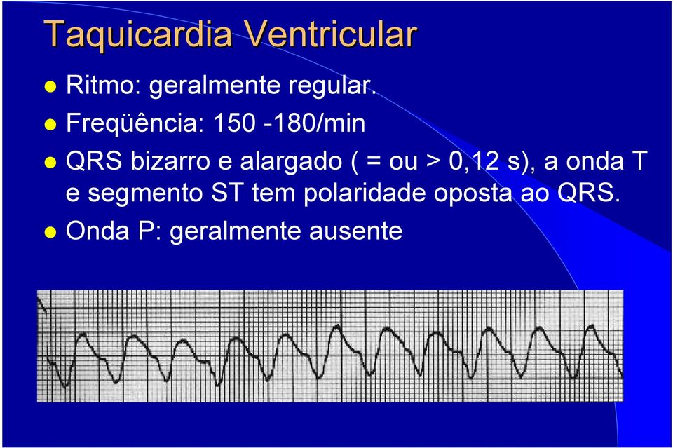 Freqüência: 150-180/min QRS bizarro e alargado (