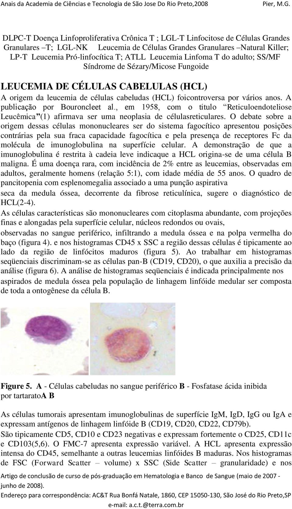 A publicação por Bouroncleet al., em 1958, com o título Reticuloendoteliose Leucêmica (1) afirmava ser uma neoplasia de célulasreticulares.