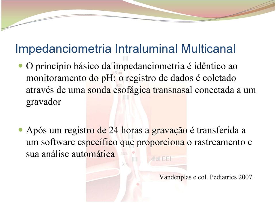 conectada a um gravador Após um registro de 24 horas a gravação é transferida a um software