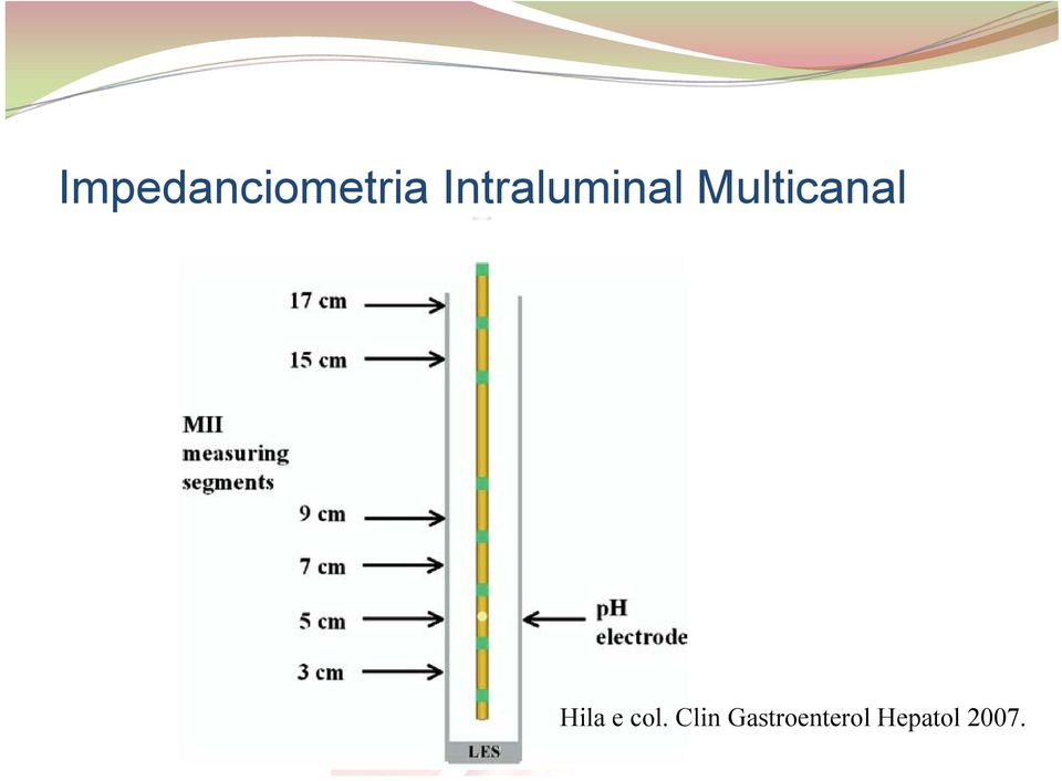 Multicanal Hila e col.