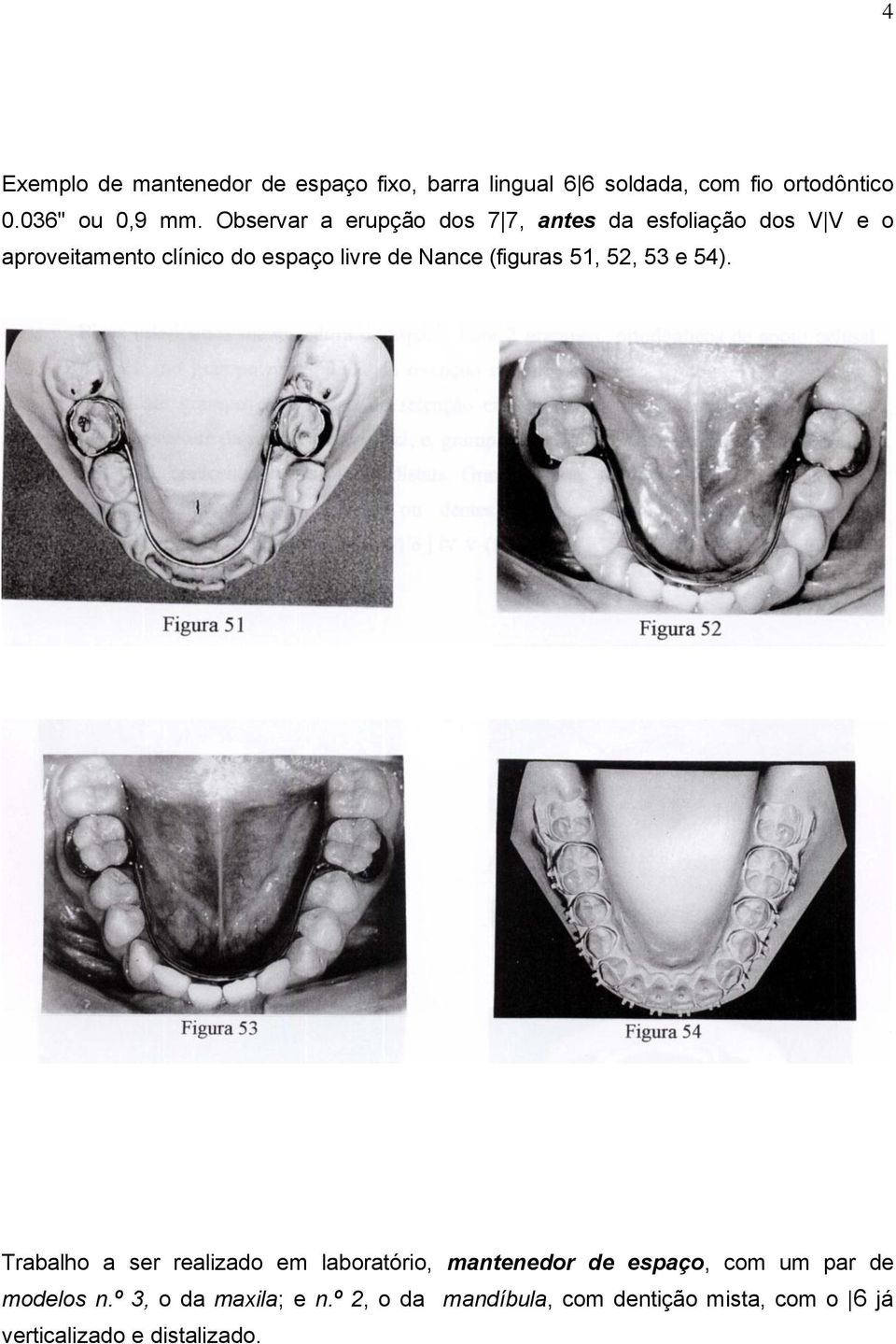 (figuras 51, 52, 53 e 54).