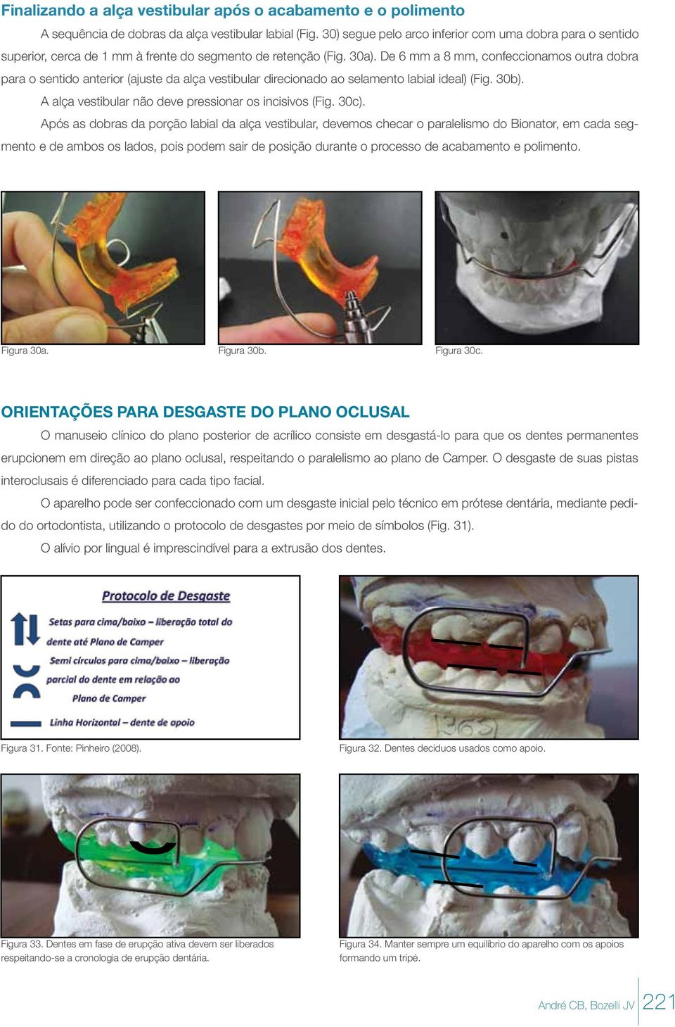 De 6 mm a 8 mm, confeccionamos outra dobra para o sentido anterior (ajuste da alça vestibular direcionado ao selamento labial ideal) (Fig. 30b).