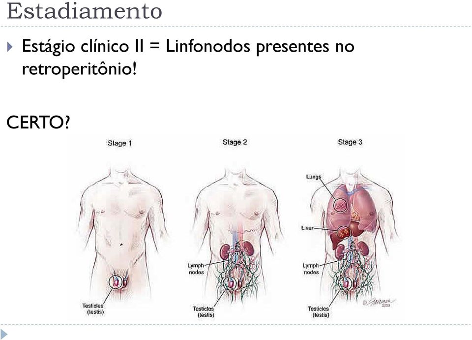 = Linfonodos