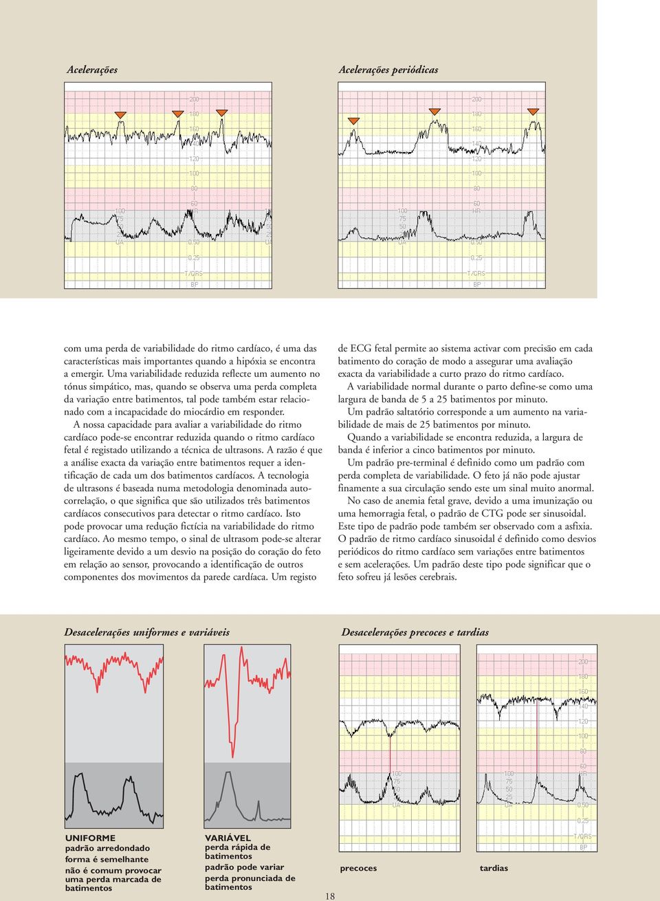 miocárdio em responder. A nossa capacidade para avaliar a variabilidade do ritmo cardíaco pode-se encontrar reduzida quando o ritmo cardíaco fetal é registado utilizando a técnica de ultrasons.