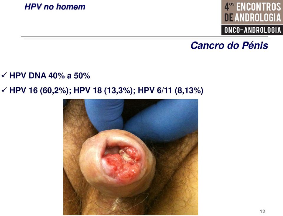 (60,2%); HPV 18