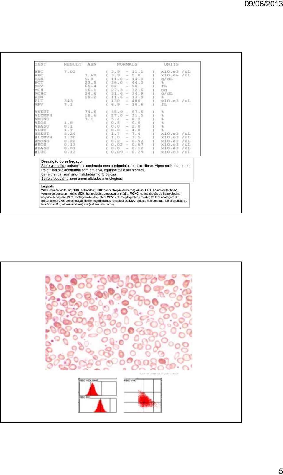 hematócrito; MCV: volume corpuscular médio; MCH: hemoglobina corpuscular média; MCHC: concentração de hemoglobina corpuscular média; PLT: contagem de plaquetas; MPV: volume plaquetário médio;