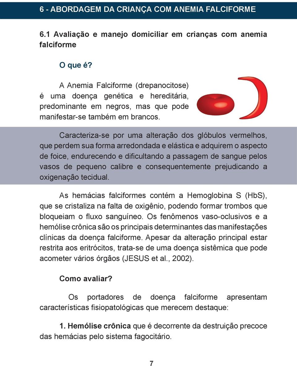 Caracteriza-se por uma alteração dos glóbulos vermelhos, que perdem sua forma arredondada e elástica e adquirem o aspecto de foice, endurecendo e difi cultando a passagem de sangue pelos vasos de