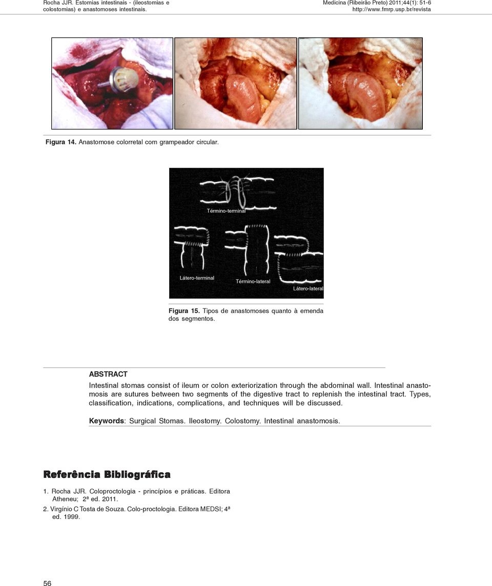 Intestinal anastomosis are sutures between two segments of the digestive tract to replenish the intestinal tract. Types, classification, indications, complications, and techniques will be discussed.