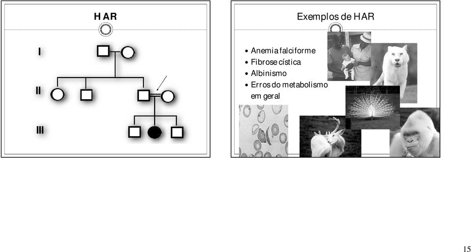 Fibrose cística