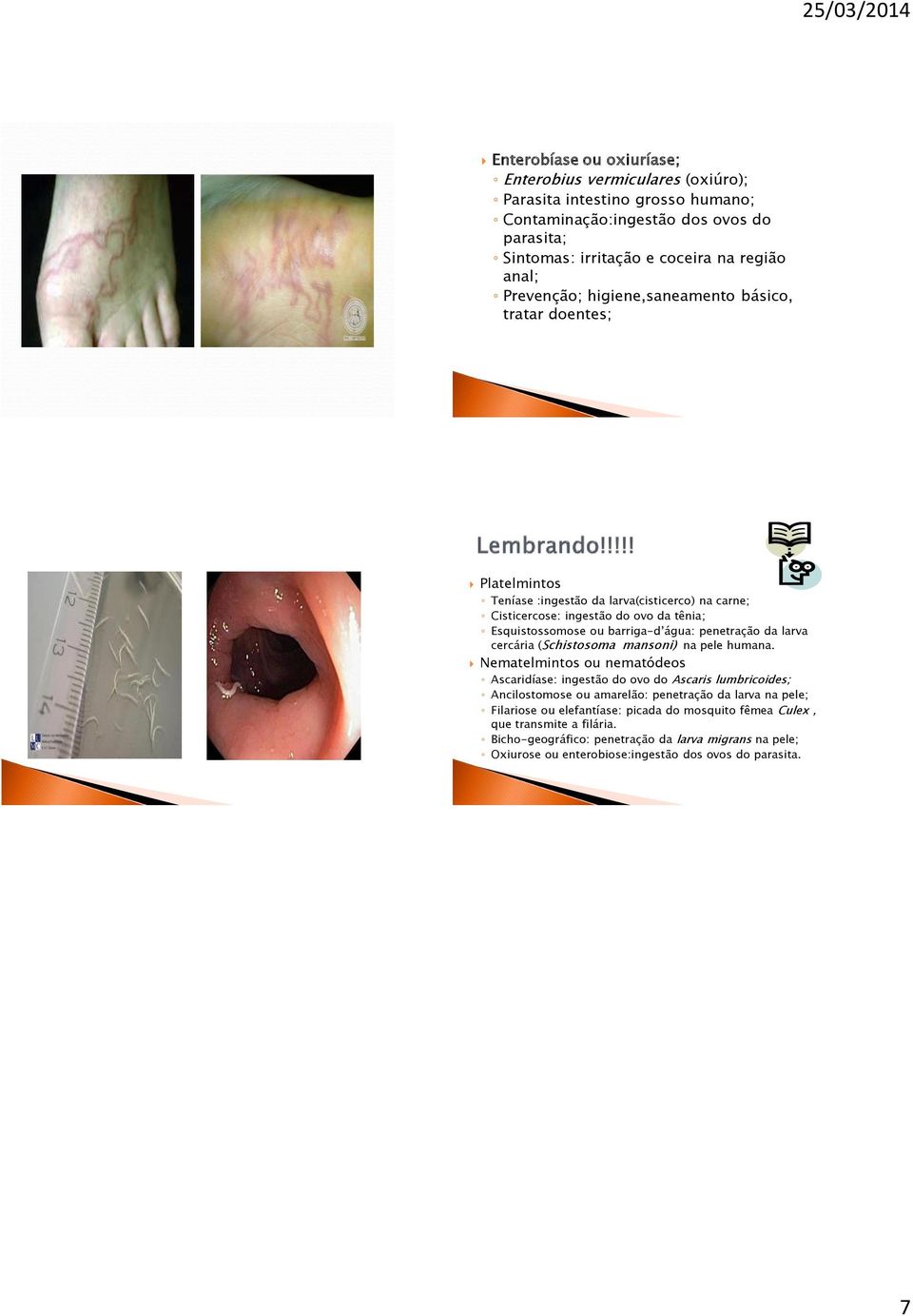penetração da larva cercária (Schistosoma mansoni) na pele humana.