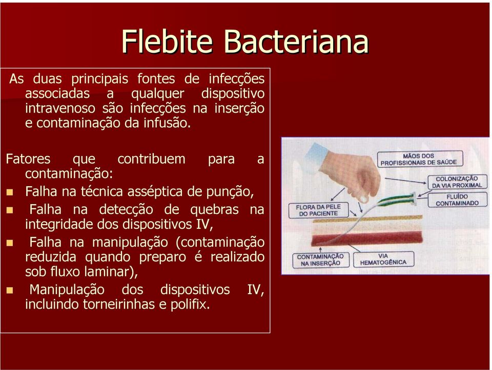 Fatores que contribuem para a contaminação: Falha na técnica asséptica de punção, Falha na detecção de quebras na