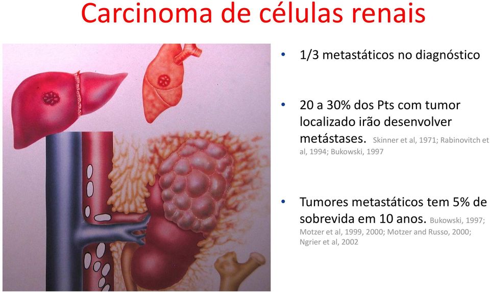 Skinner et al, 1971; Rabinovitchet al, 1994; Bukowski, 1997 Tumores
